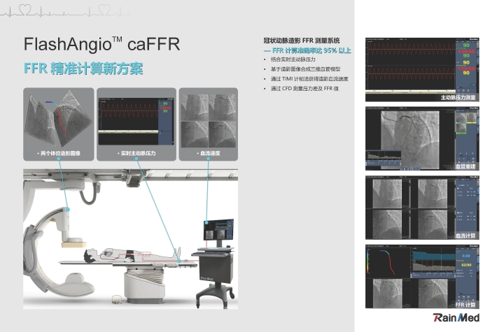 冠状动脉造影血流储备分数测量系统图片3