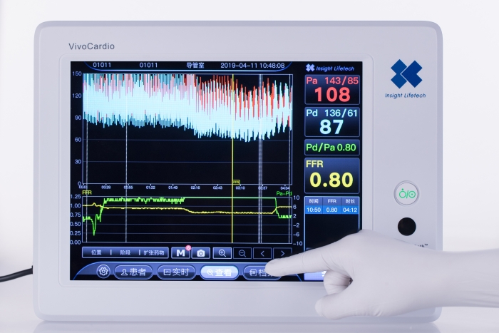 血流储备分数测量设备图片